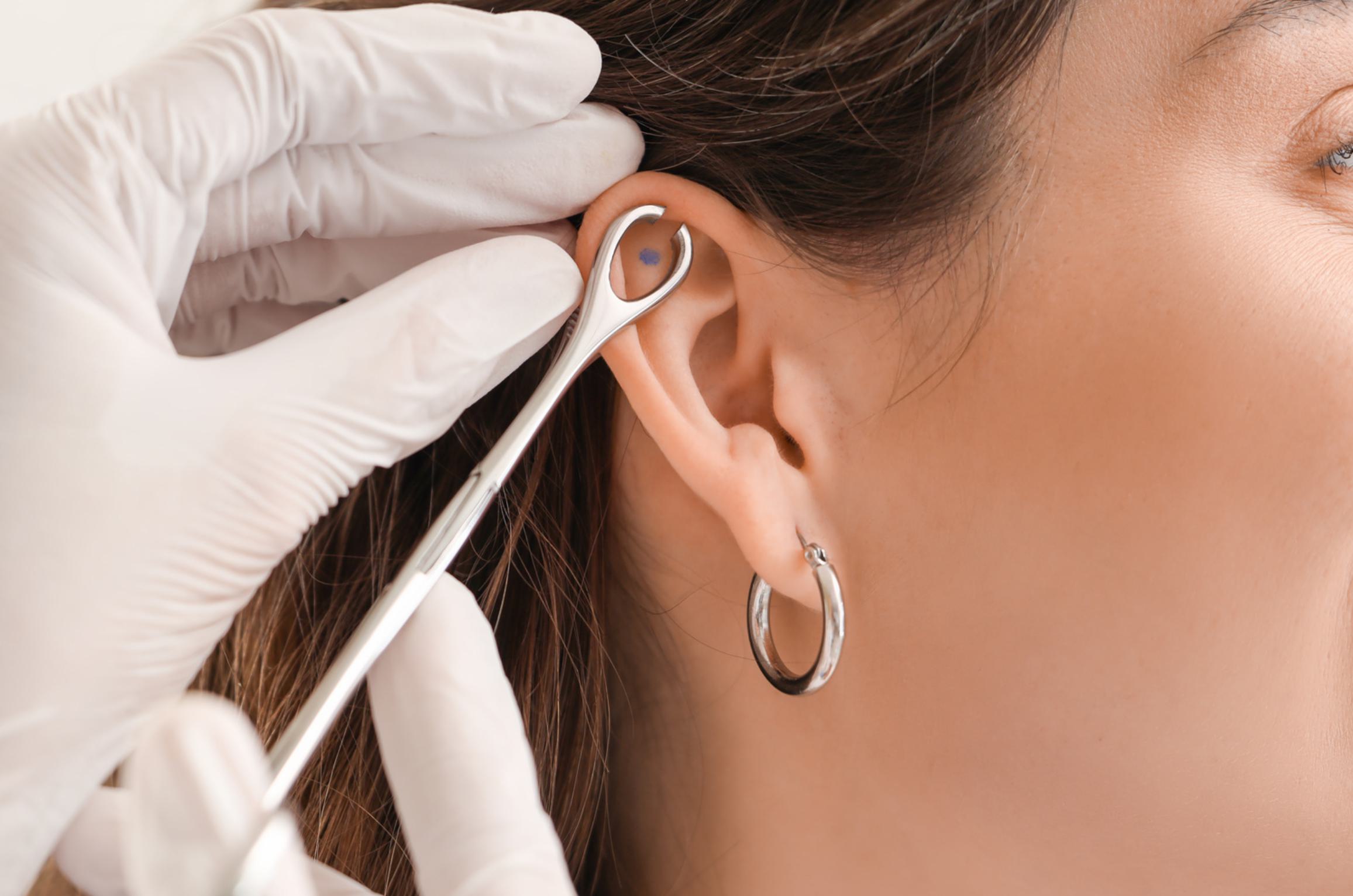 Dr. Shirisha Skin, Hair & Laser Clinic
