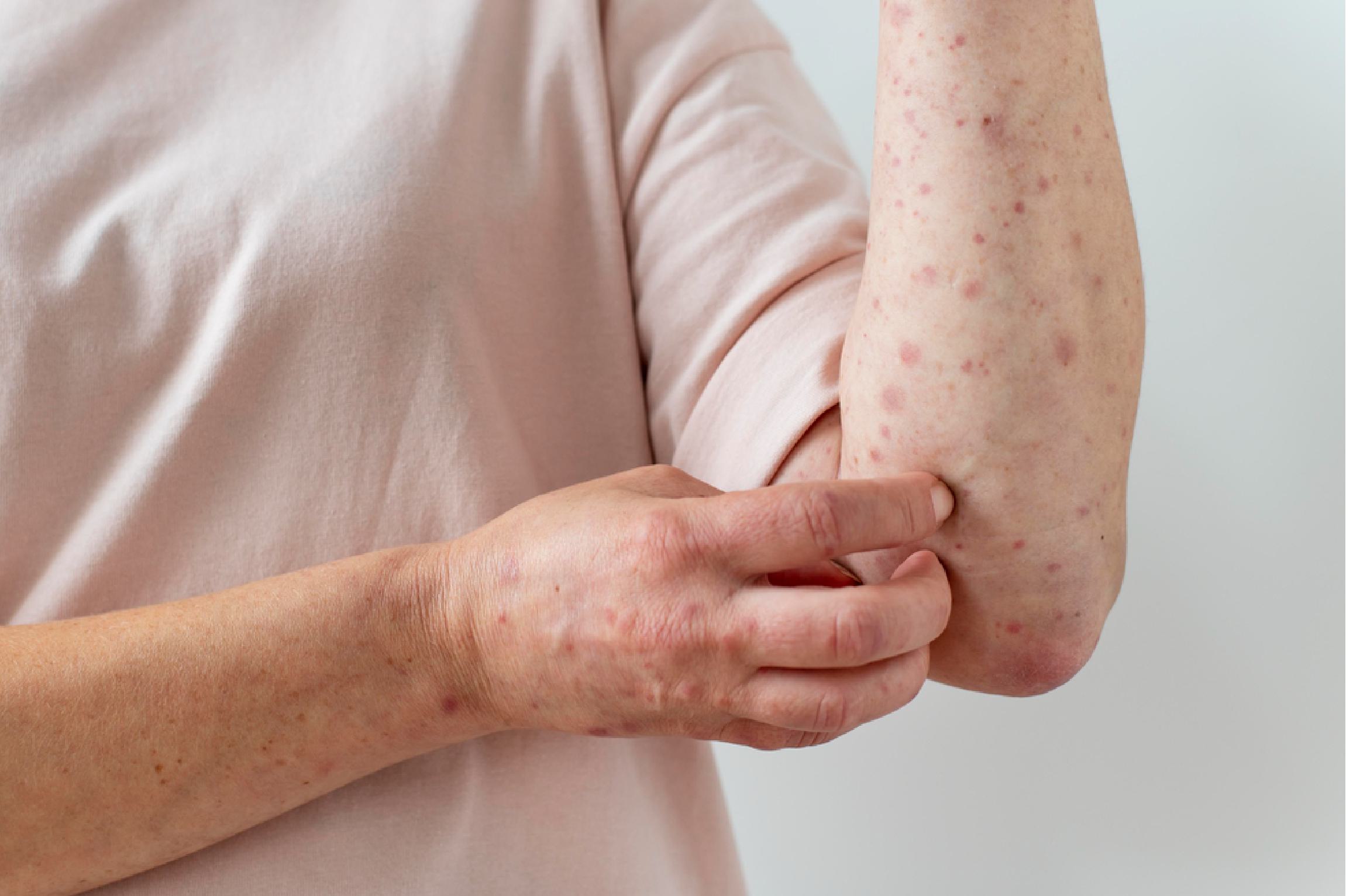 Dr. Shirisha Skin, Hair & Laser Clinic